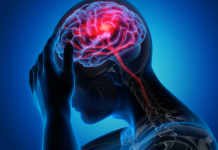 Santé publique – Face à l’urgence des AVC, le système de prise en charge se réorganise